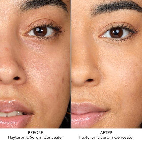 By Terry By Terry Hyaluronic Serum Concealer (Various Shades) Spedizione Gratuita