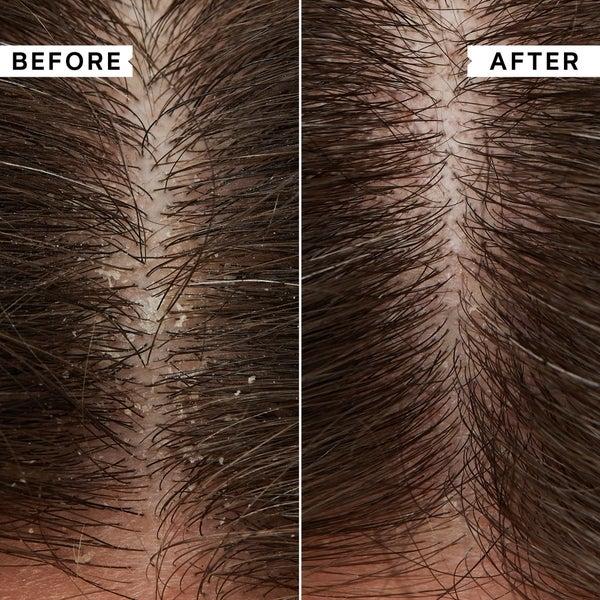 Philip Kingsley Philip Kingsley Flaky Itchy Scalp Shampoo 1000ml - (del valore di £ 88.00) Offerta natalizia