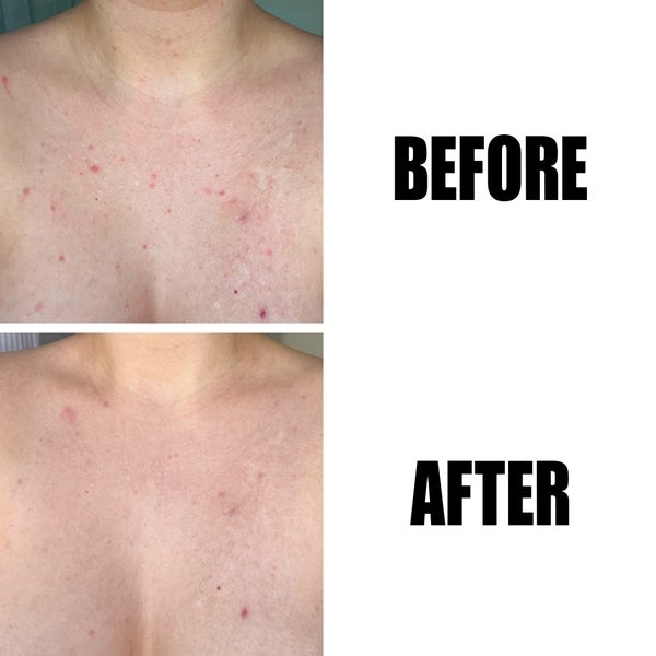 The INKEY List The INKEY List Glycolic Acid Exfoliating Body Stick 45g Affare Del Giorno