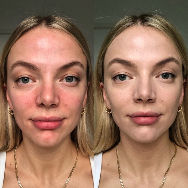 Dr.Jart+ Dr.Jart+ Cicapair Tiger Grass Color Correcting Treatment 15ml Offerta migliore