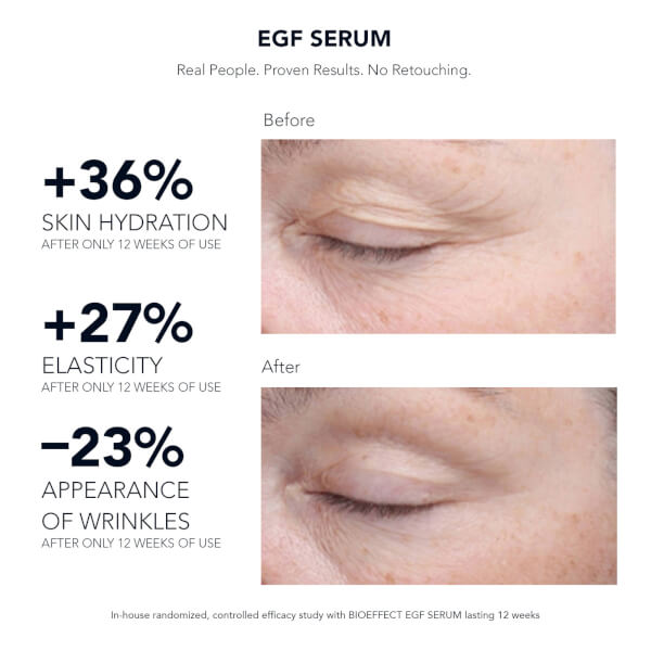 BIOEFFECT BIOEFFECT EGF Serum 15ml Consegna Veloce