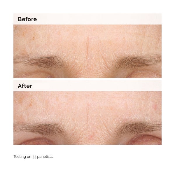 The Ordinary The Ordinary Retinal 0.2% Emulsion 15ml Sostegno trimestrale